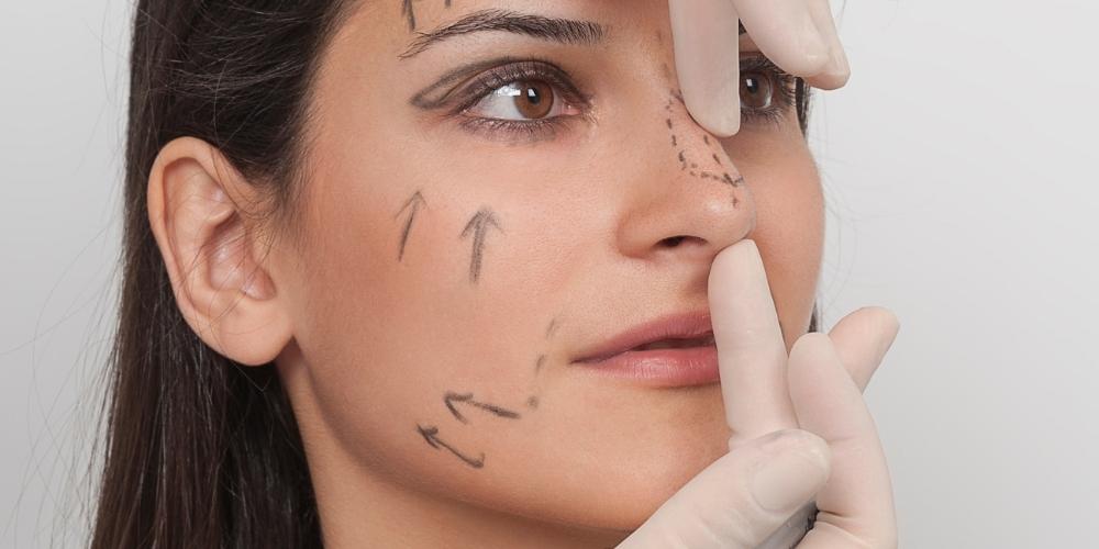 revizyon rinoplasti revizyon rinoplasti