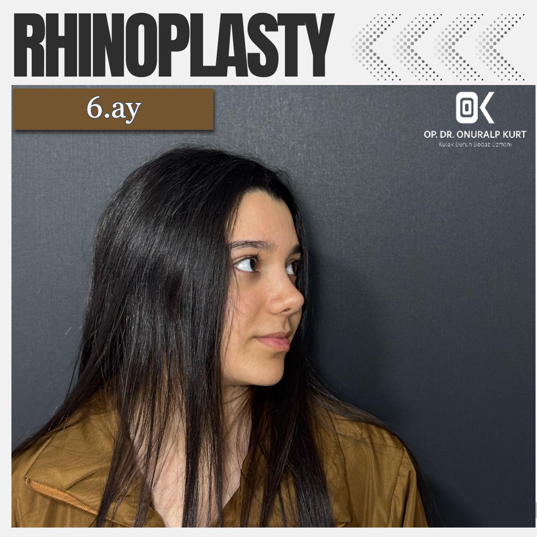 WhatsApp Görsel 2025-04-17 saat 17.32.15_7ceec905