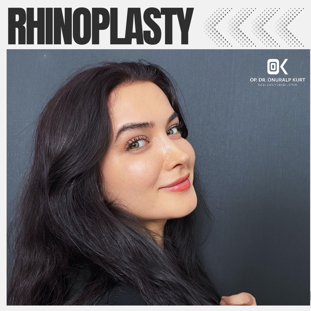 WhatsApp Görsel 2025-04-17 saat 17.32.15_aaba63db