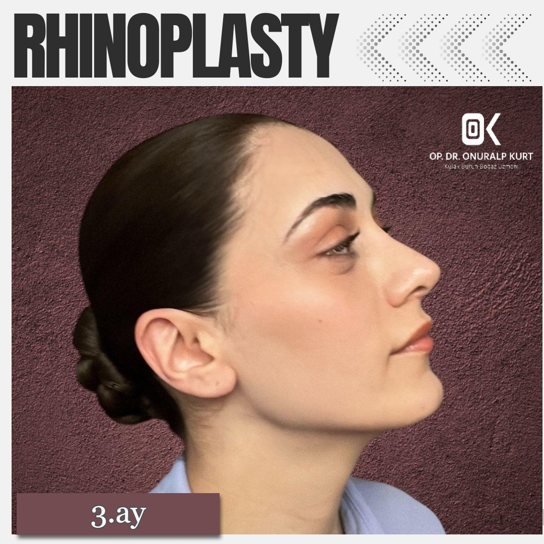 WhatsApp Görsel 2025-04-17 saat 17.32.16_44aaa20d