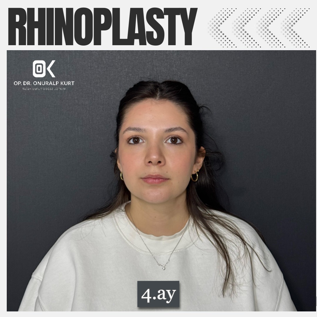 WhatsApp Görsel 2025-04-17 saat 17.32.16_562249aa