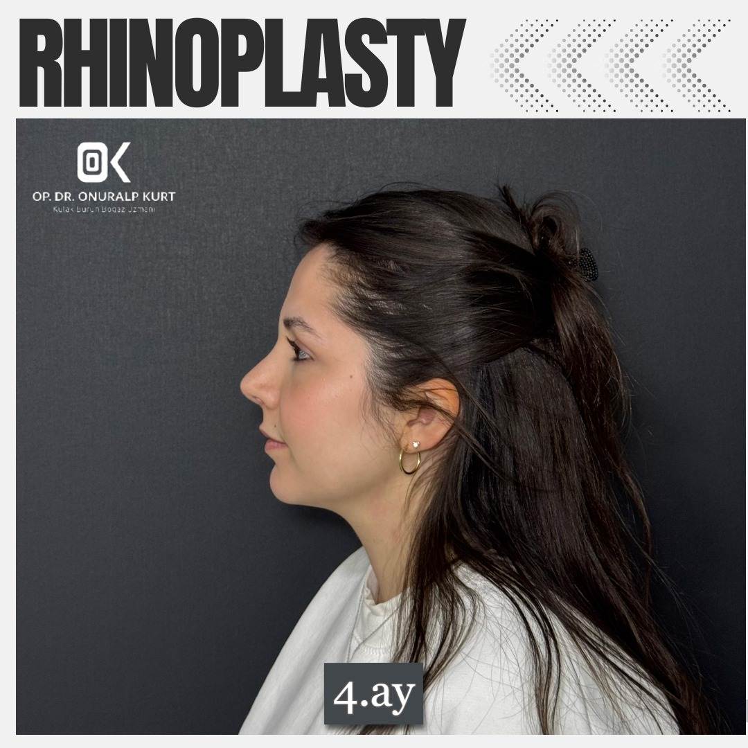 WhatsApp Görsel 2025-04-17 saat 17.32.16_bba5fe60