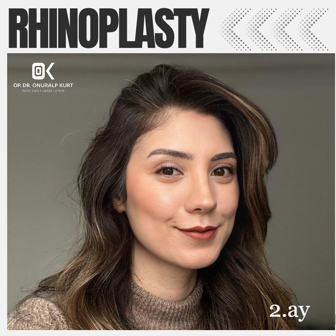 WhatsApp Görsel 2025-04-17 saat 17.32.17_60bce866