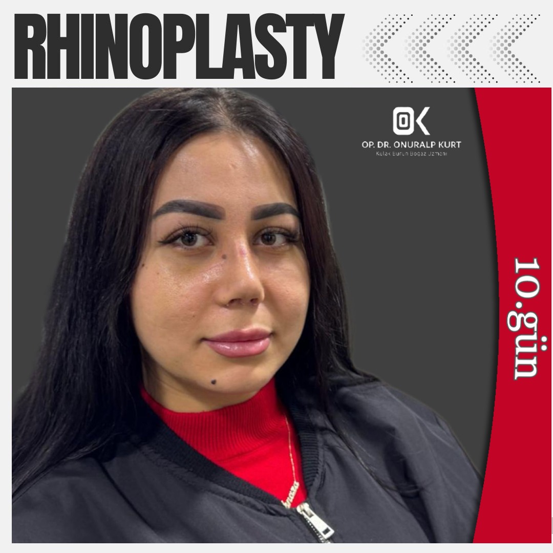 WhatsApp Görsel 2025-04-17 saat 17.32.17_83fb2595