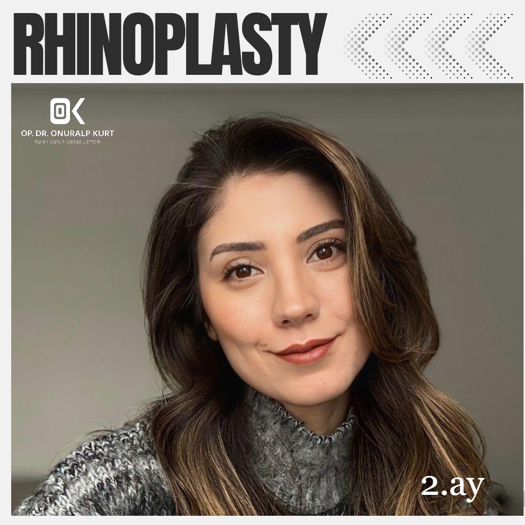 WhatsApp Görsel 2025-04-17 saat 17.32.17_c7b5fd60